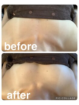 ギンザアール(GINZA R.)/平日お得にバストケア！