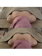 ボニー(BONNY)/バストビフォーアフター☆