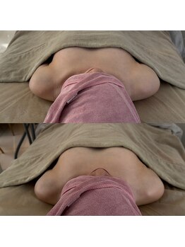 ボニー(BONNY)/バストビフォーアフター☆