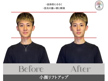 十色 横浜/小顔リフトUPですっきり[たるみ]