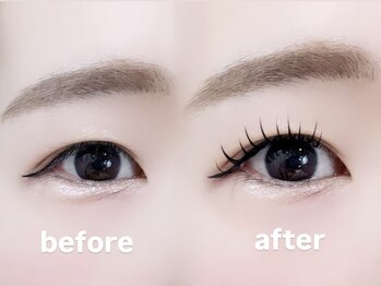 ロピ 江坂(LOPI)/&Healthy(アンドヘルシー)100本