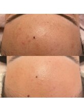 エクラ(eclat)/クリスティーナ