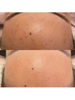 エクラ(eclat)/クリスティーナ