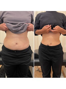 ナオ接骨院(NAO接骨院)/Before/After