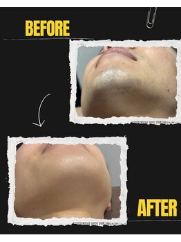 デサフィオ(Desafio.sln)/髭