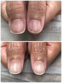 エルナ(elna)/爪の形が変わる!