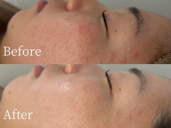 スウィート リリー(Sweet Lily)/韓国肌管理★肌質改善