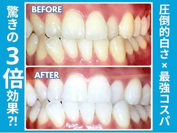 エクシアホワイトニング 札幌駅前店