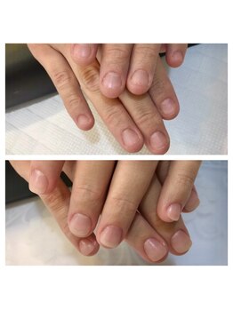 リーフ(Leaf)/長さ形をその場で形成