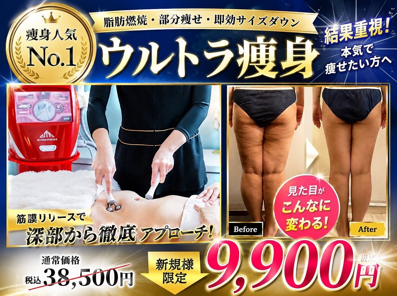 Puretrode REALIZE Beauty 痩身エステ器 ビテュセ(美Tu sais)｜ホットペッパービューティー