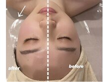 エクシア(ECXIA)/◇コルギ比較写真