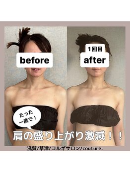 クチュール(couture.)/デコルテ、お背中の施術