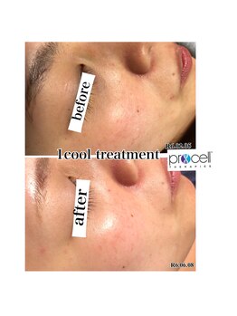 ヒルナム(Heal Nam)/プロセルセラピーズ~フェイス~