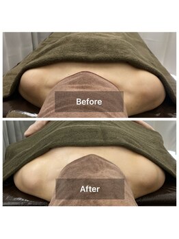 神谷澤鍼灸整骨院/before after