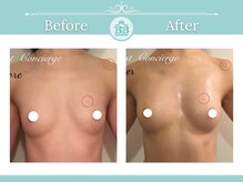 美人バスト 豊橋店/バストアップ症例【バストケア】