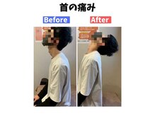 美波整体院 本宮院/首の痛み(Before After)