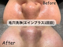 【エインプラス】加熱式水蒸気式で潤いながら毛穴レス肌へ☆