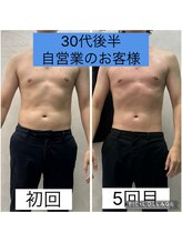 エクラ(Eclat)/Eclatの痩身★BeforeAfter10