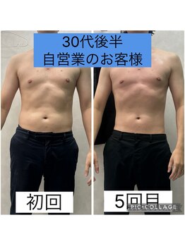 エクラ(Eclat)/Eclatの痩身★BeforeAfter10