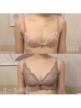 ベルファム(BelleFemme)/バストアップ/バストケア/育乳