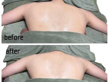 スカイ(sky)の雰囲気（お悩みに合わせたブライダルプラン☆肩の厚みが取れ華奢な印象に）