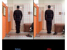 ゼロヒャク整骨院(ZERO100整骨院)/猫背矯正×骨盤矯正