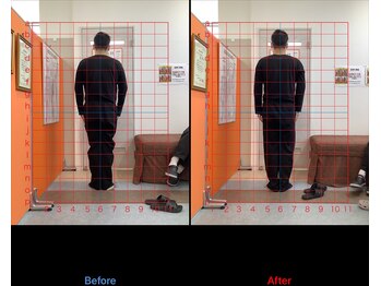 ゼロヒャク整骨院(ZERO100整骨院)/猫背矯正×骨盤矯正