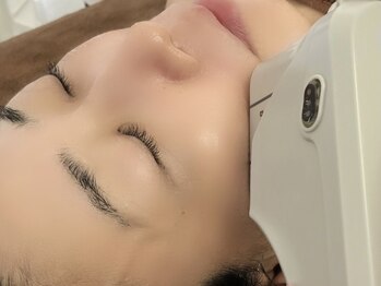 サロンドシェリー(salon de cherie)/小顔