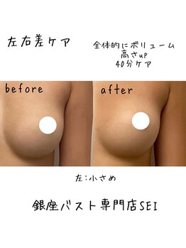 セイ(SEI)/B→A 左右差：左