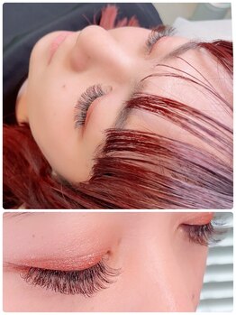 アイリー(i’rry)/ドーリーアイにバインドロック