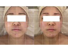 サロン リーナ 北千住店(Salon Lena)/商標登録手技★骨造コルゾウ