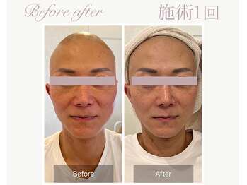 パルタージュ(Partage)/