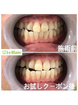 ルブラン 奈良店(Le Blanc)/フリーパスコースは