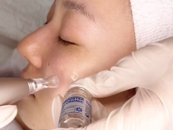 トゥービー(TO.BE)の写真/【韓国艶美肌】水光生美容液ピーリングで毛穴/ニキビケア/シミ改善◎自信の持てる、水光グロス肌へ♪