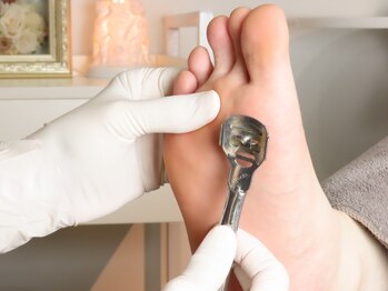 フスフレーゲ 新宿御苑店ルーエの写真/【角質/魚の目など気になるお肌のケア】本番ドイツ直伝の技術で徹底ケア!