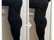 ヨサパーク ルポ(YOSA PARK ropos)/ルルオン４回連続