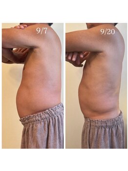 エヌア(nA)/ビフォーアフター60代男性＾＾