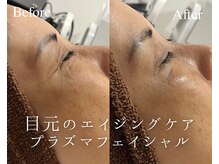 エイジングケア