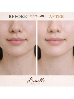 ルネル(Lunelle)/近距離も余裕♪