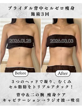 シーフェイス 横浜店(SEE FACE)/横浜駅近ブライダル痩身エステ