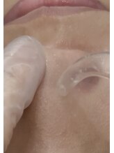 ビーサロン(B-salon)/韓国式3D毛穴洗浄