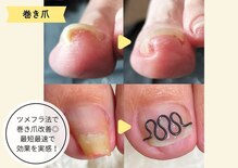 フレッシュフット(FreshFoot)
