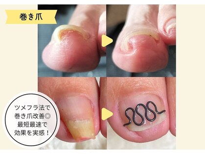 フレッシュフット(FreshFoot)の写真