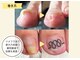 フレッシュフット(FreshFoot)の写真