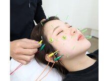 ゆず鍼灸整骨院/小顔美肌美容鍼