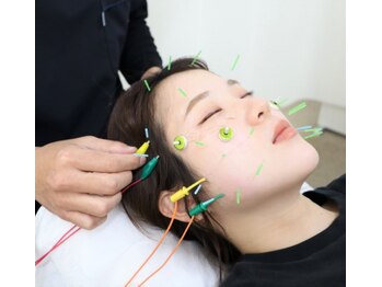 ゆず鍼灸整骨院/小顔美肌美容鍼