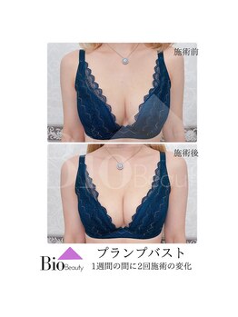 バイオビューティー 神戸本店(Bio Beauty)/プランプバスト　体験コース症例