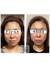 キュープ 小倉店(Qpu) 人気No.2 通常