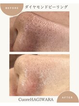 クオーレ ハギワラ(cuore HAGIWARA)/毛穴改善/開き・凹凸・黒ずみ