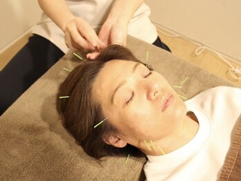 サルース(Salus)の写真/人気No.1【圧倒的効果◎】美容鍼+小顔矯正+ヘッドマッサージ¥9900で美肌×小顔を叶える＊しわ/たるみ改善◎